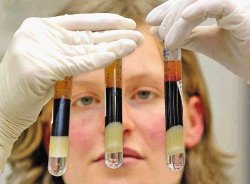 en caso de sospecha de contagio